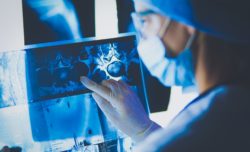 Doctor looking at xrays regarding information on Roundup possibly causing cancer