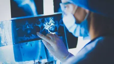 Doctor looking at xrays regarding information on Roundup possibly causing cancer