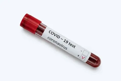 Blood vial with positive coronavirus test label - Good Samaritan Society