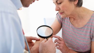 A doctor examining a woman's arm regarding the Picato cancer risks class action lawsuit