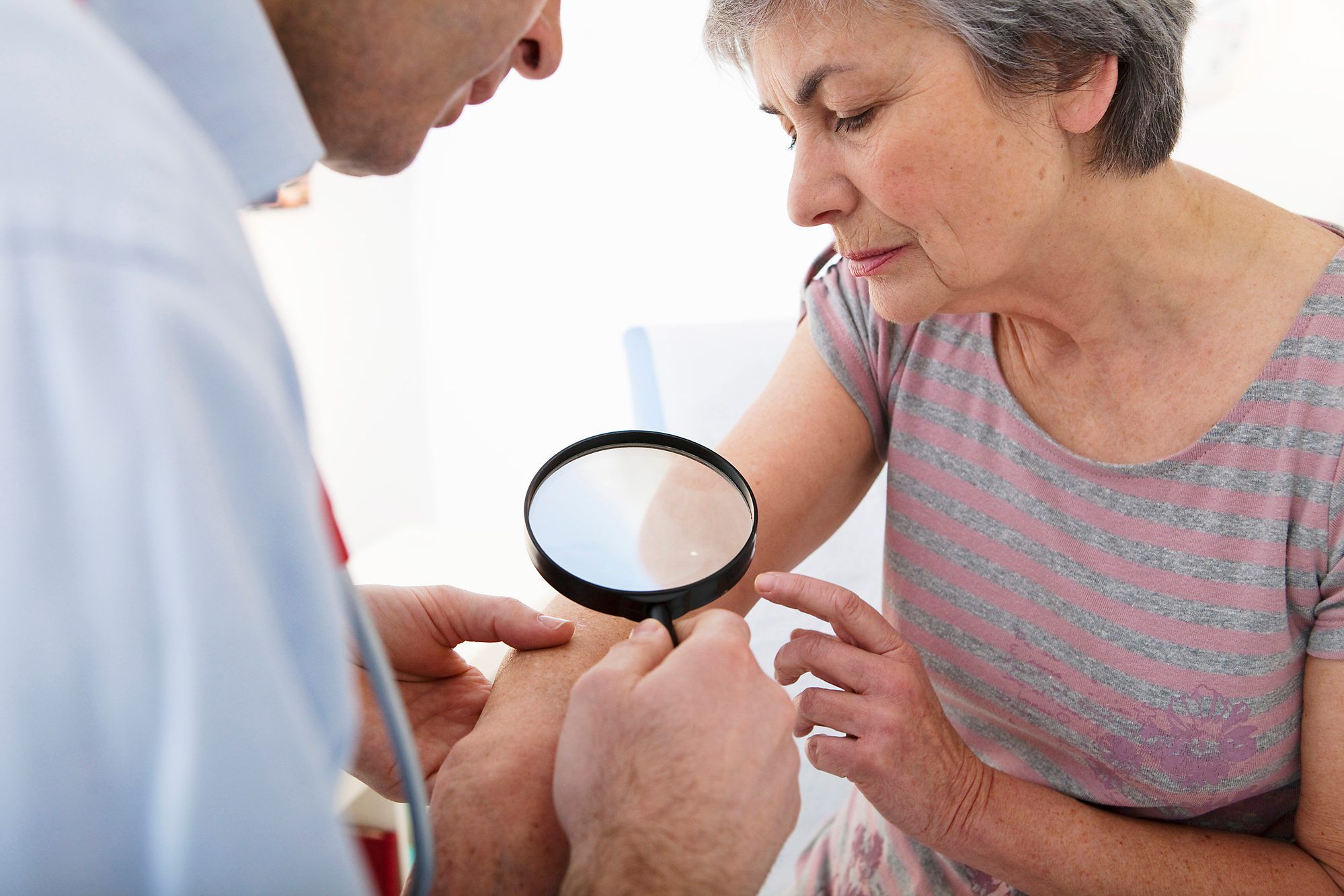 A doctor examining a woman's arm regarding the Picato cancer risks class action lawsuit 