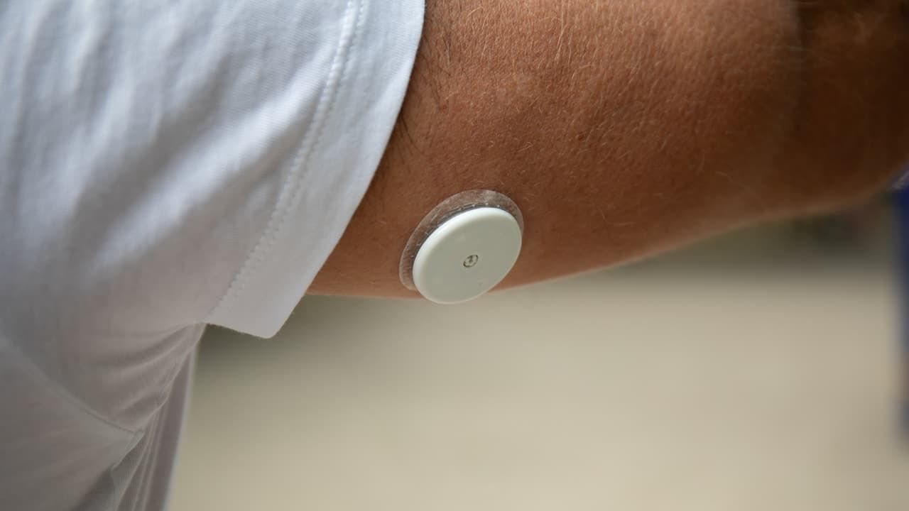 Man Wearing Freestyle Libre Sensor on Arm
